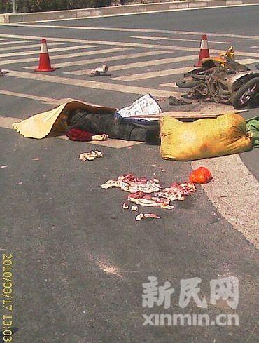 癫痫患者是否可以正常的结婚生子【IM电竞】(图2) IM电竞平台