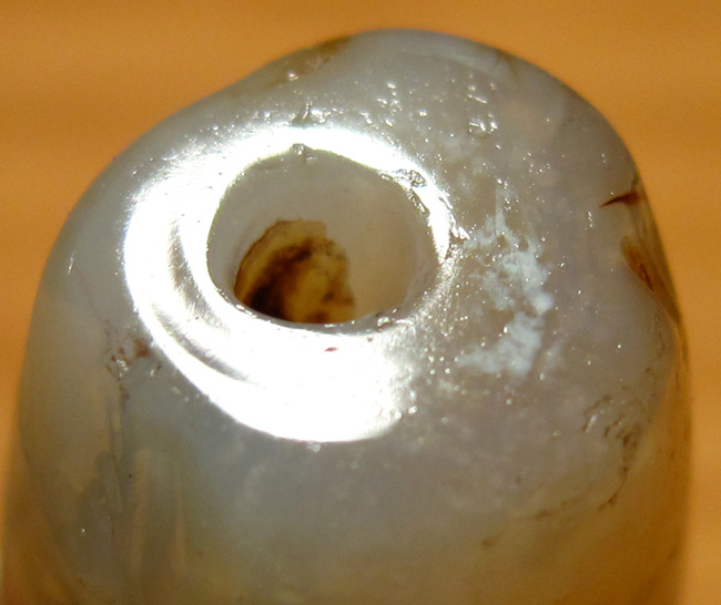 【IM电竞官网】康复治疗是伤病治疗中重要的组成部分